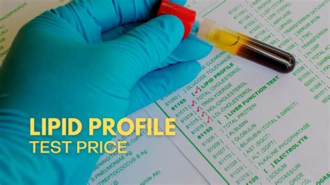 lipid profile test price